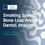 Smoking Speeds Bone Loss Around Dental Implants