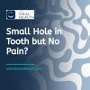 Small Hole in Tooth