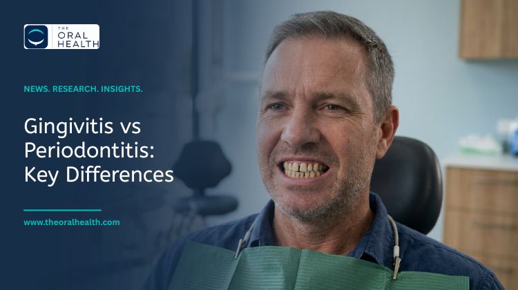 gingivitis vs periodontitis